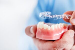 Invisalign braces